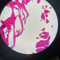 Photo of histology slide from undergraduate research.